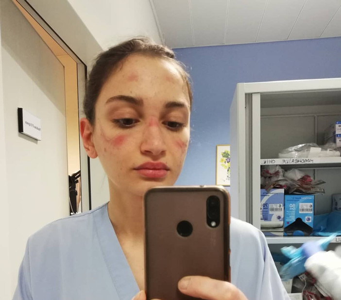 Alessia Bonari, il suo selfie è diventato il simbolo della lotta al covid