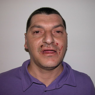 Alessandro Rivara Alessandro Rivara