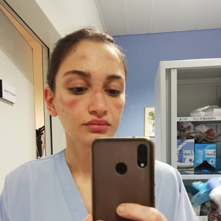 Alessia Bonari, il suo selfie è diventato il simbolo della lotta al covid