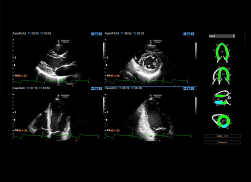 Da Athena Medica l'attività diagnostica è ancora più precisa e sicura grazie al nuovo e innovativo Ecografo SAMSUNG RS80A Da Athena Medica l'attività diagnostica è ancora più precisa e sicura grazie al nuovo e innovativo Ecografo SAMSUNG RS80A