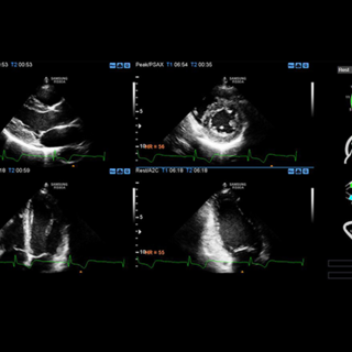 Da Athena Medica l'attività diagnostica è ancora più precisa e sicura grazie al nuovo e innovativo Ecografo SAMSUNG RS80A