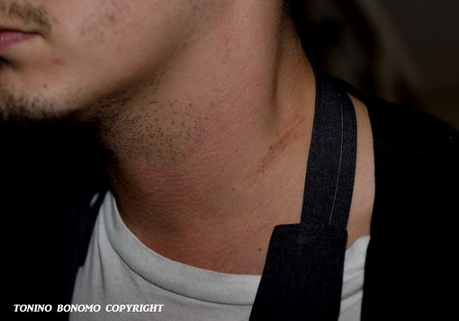 La ferita provocata dallo strappo della collana La ferita provocata dallo strappo della collana