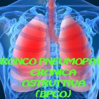 Salute e Benessere: che cosa è la BPCO? Cause, sintomi e diagnosi Salute e Benessere: che cosa è la BPCO? Cause, sintomi e diagnosi