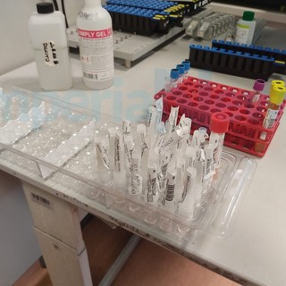 Coronavirus: 46 nuovi contagi oggi in provincia ma tasso di positività stazionario, calano i ricoverati Coronavirus: 46 nuovi contagi oggi in provincia ma tasso di positività stazionario, calano i ricoverati