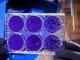 Forse una buona notizia dalla Francia nella lotta al Coronavirus: al via la sperimentazione su larga scala di un nuovo farmaco
