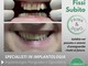 Presso lo Studio Dentistico Marazzi a Sanremo, implantologia computer assistita senza dolore Presso lo Studio Dentistico Marazzi a Sanremo, implantologia computer assistita senza dolore