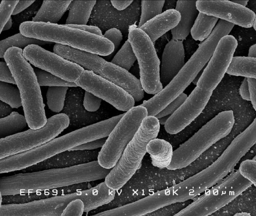 E. Coli Bacteria - Credit: NIAID E. Coli Bacteria - Credit: NIAID