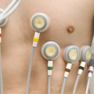 Certificati per l’attività sportiva non agonistica: da quest’anno occorre anche l’elettrocardiogramma