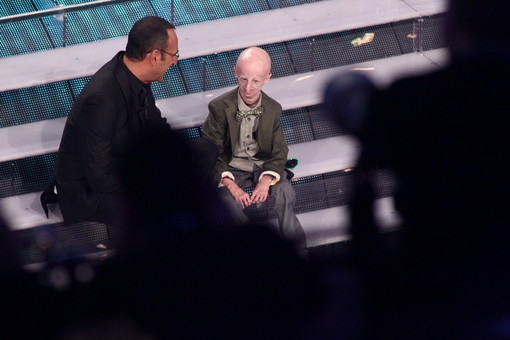 Sul palco della Teatro Ariston di #Sanremo2105 Sammy Basso porta l'ottimismo vero