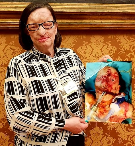 Filomena Lamberti Filomena Lamberti