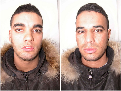 Sanremo: arrestati pusher, uno dei compratori all'Ospedale dopo aver inghiottito un ovulo Sanremo: arrestati pusher, uno dei compratori all'Ospedale dopo aver inghiottito un ovulo