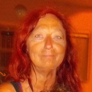 Sanremo: 62enne morta dopo un intervento alla tiroide, tre medici dell'ospedale rinviati a giudizio