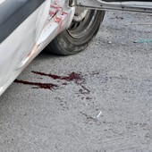 Gambizzato ieri a Poggio di Sanremo: 40enne moldavo trasferito al Santa Corona dopo un'operazione ieri Gambizzato ieri a Poggio di Sanremo: 40enne moldavo trasferito al Santa Corona dopo un'operazione ieri