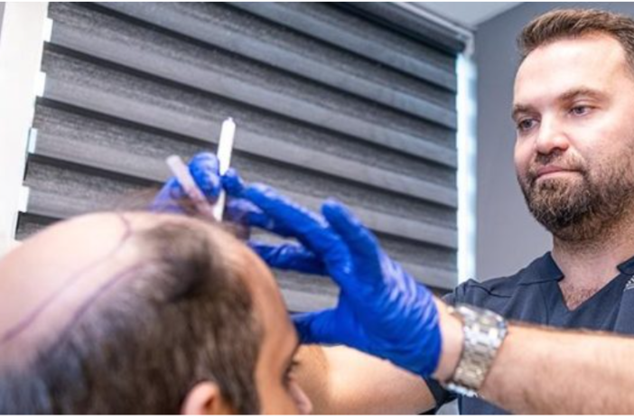 Chi esegue davvero il vostro trapianto di capelli: un medico o un tecnico? Chi esegue davvero il vostro trapianto di capelli: un medico o un tecnico?