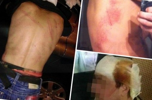 Scontri dopo Unione Sanremo-Imperia: i tifosi della 'Brigade Sud' denunciano violenze delle forze di Polizia