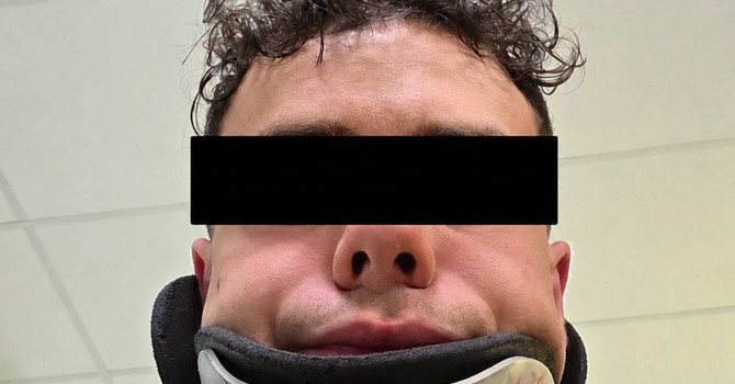 Serata da incubo a Sanremo: 23enne cuneese rapinato e malmenato da un gruppo di otto ragazzi Serata da incubo a Sanremo: 23enne cuneese rapinato e malmenato da un gruppo di otto ragazzi