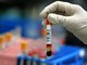 Difficoltà per prenotare analisi del sangue, un lettore racconta la sua esperienza Difficoltà per prenotare analisi del sangue, un lettore racconta la sua esperienza