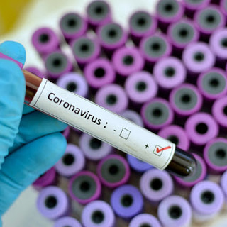 Coronavirus: stazionario il rapporto tamponi-positivi (10,16%), 5 morti ma aumentano ospedalizzati e terapie intensive