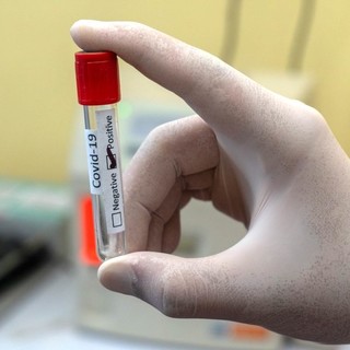 Coronavirus: consueto calo dei nuovi positivi dopo i pochi tamponi del weekend, tasso al 3,17%. Stabili i ricoverati