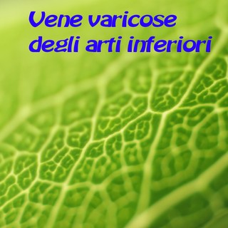 Salute e Benessere: cosa sono le vene varicose? Salute e Benessere: cosa sono le vene varicose?