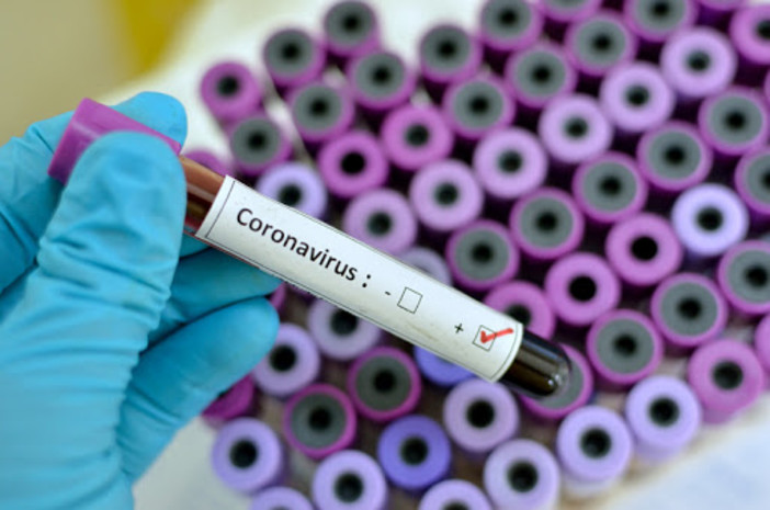 Coronavirus: il Prefetto &quot;Restrizioni anti Covid-19 estese da Nizza a tutta la Costa Azzurra&quot;