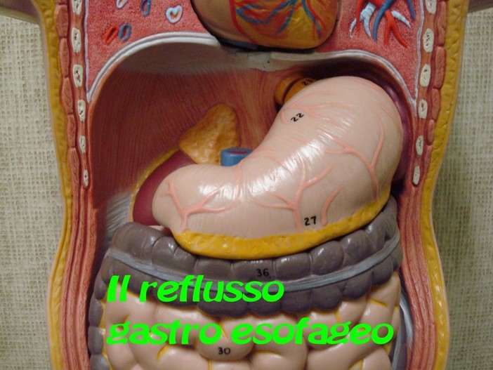 Salute e Benessere: il reflusso gastro esofageo