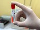 Coronavirus, oggi solo due nuovi casi positivi e sette guarigioni nel Principato di Monaco