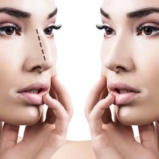 Chirurgia estetica, di cosa si occupa?