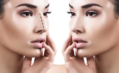Chirurgia estetica, di cosa si occupa?