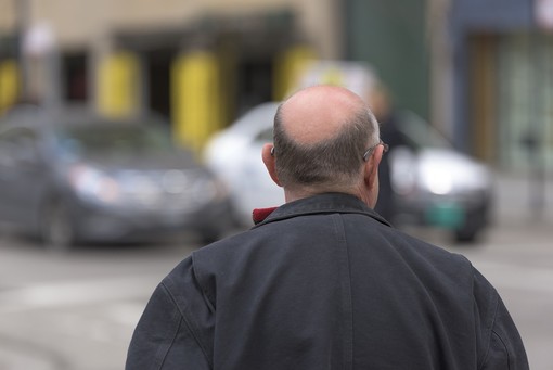 Addio stempiatura, la soluzione è nella patch cutanea Addio stempiatura, la soluzione è nella patch cutanea