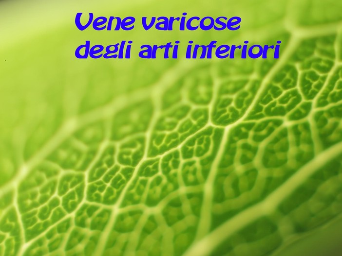 Salute e Benessere: cosa sono le vene varicose?