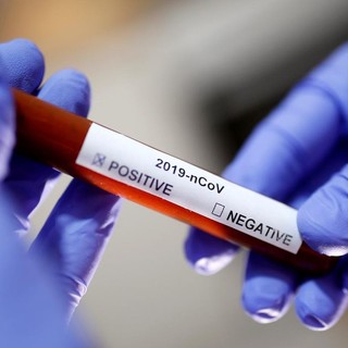 Coronavirus: tornano finalmente le cure monoclonali in provincia di Imperia, ne sono arrivate 40 Coronavirus: tornano finalmente le cure monoclonali in provincia di Imperia, ne sono arrivate 40