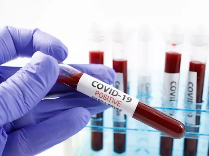 Coronavirus: nuovo caso di Covid-19 oggi riscontrato nel Principato di Monaco