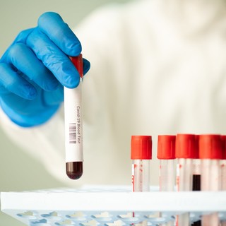 Covid, 84 nuovi casi oggi nel Principato di Monaco: il tasso di positività sale al 12,53%