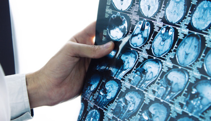 La Liguria acquista oltre 130.000 prestazioni di diagnostica per immagini, Toti: "Con delibera di Alisa, arriva contributo decisivo per lotta alle liste d’attesa" La Liguria acquista oltre 130.000 prestazioni di diagnostica per immagini, Toti: "Con delibera di Alisa, arriva contributo decisivo per lotta alle liste d’attesa"