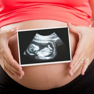 Assistenza alle donne musulmane durante la gravidanza. Ecco i criteri fondamentali