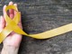 Giornata mondiale dell’Endometriosi, patologia che colpisce il 10-15% delle donne in età riproduttiva Giornata mondiale dell’Endometriosi, patologia che colpisce il 10-15% delle donne in età riproduttiva