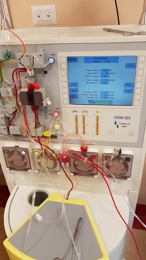 All'ospedale di Imperia, ieri per la prima volta in Italia è stata utilizzata una tecnica per la cura della dermatite atopica