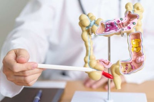 Prevenzione del tumore al colon-retto: screening gratuito di ASL 1 per la salute