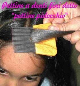 Benessere Salute La Pediculosi Ovvero Il Pidocchio Sanremonews It