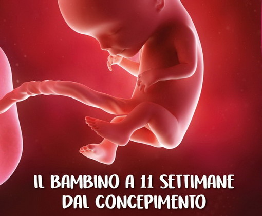 Per la campagna Prolife, un camion vela per ricordare i quarant’anni dell'introduzione della legge 194 sull’aborto in Italia