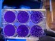 Analisi legionella: chi valuta il rischio e come