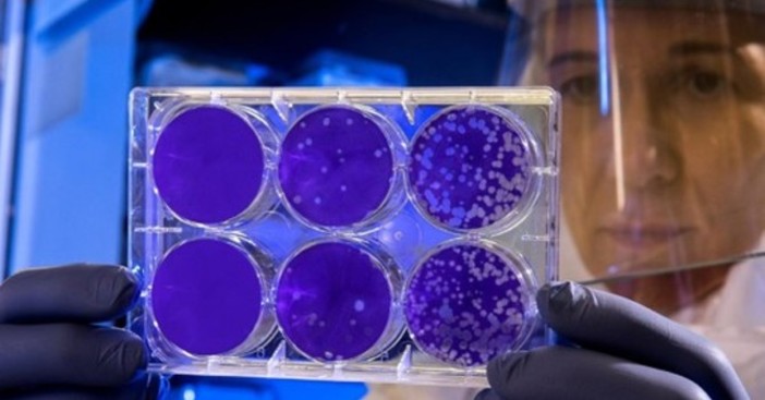 Analisi legionella: chi valuta il rischio e come