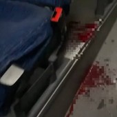 Lite sul bus tra Sanremo e Taggia, passeggero colpito al volto: intervengono Carabinieri e ambulanza Lite sul bus tra Sanremo e Taggia, passeggero colpito al volto: intervengono Carabinieri e ambulanza