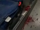 Lite sul bus tra Sanremo e Taggia, passeggero colpito al volto: intervengono Carabinieri e ambulanza Lite sul bus tra Sanremo e Taggia, passeggero colpito al volto: intervengono Carabinieri e ambulanza