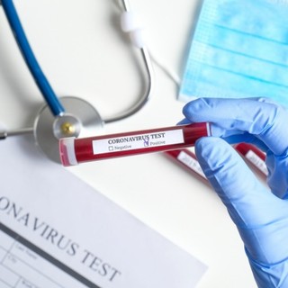 Test sierologici alle forze dell'ordine, Viale: "La Regione si farà carico delle spese"