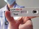 Coronavirus, scende il rapporto tamponi-positivi (5,9). Nella nostra provincia i nuovi casi sono 114 e rispetto a ieri ci sono 790 persone in più in sorveglianza attiva