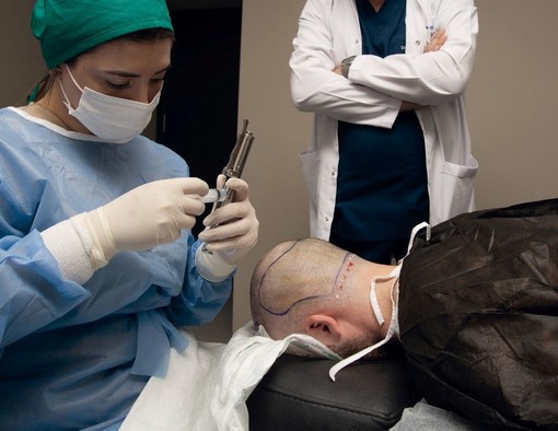 Controindicazioni del trapianto di capelli