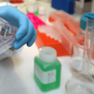 Tumori, al via studio per ridurre rischio recidive da cancro al seno Tumori, al via studio per ridurre rischio recidive da cancro al seno