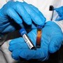Hantavirus, test negativo per la persone in isolamento in Veneto Hantavirus, test negativo per la persone in isolamento in Veneto